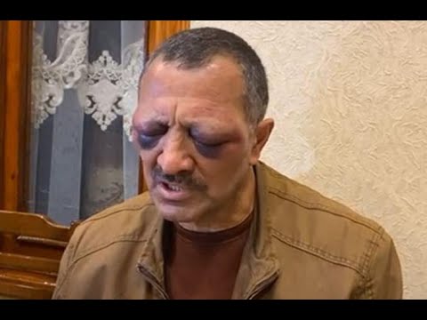 TOFİQ YAQUBLU ÜZÜNÜ MAŞINA ÇIRPIB?