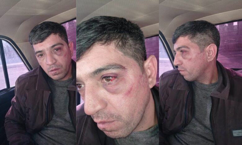 “Bərdədə polislər məni döyüb, indi də həbslə hədələyirlər”