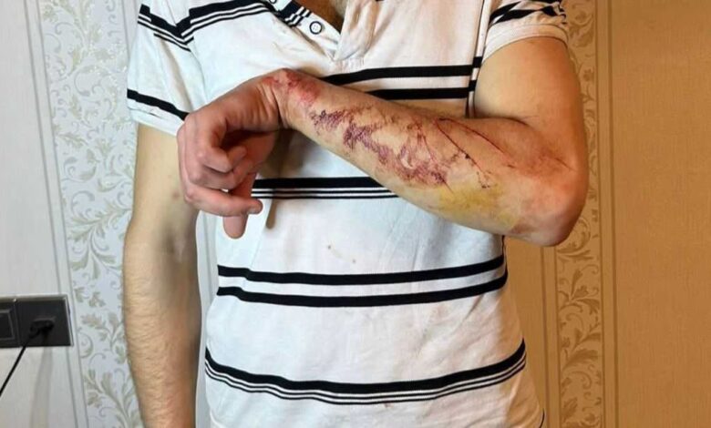 Qazi polisdə döyüldüklərini deyir: “Köşkümüzü də aldılar”