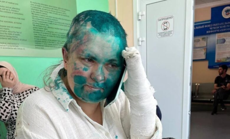 Çeçenistanda “Novaya qazeta”nın əməkdaşı ilə vəkili döyüblər