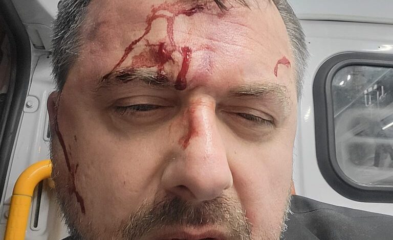 Gürcüstanda xarici agentlər haqqında qanuna etiraz edən fəallar evlərinin qarşısında döyülür